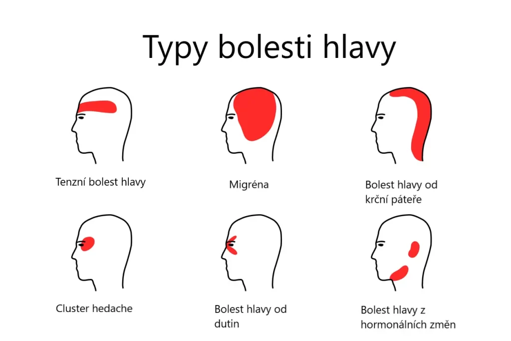 Typy bolesti hlavy